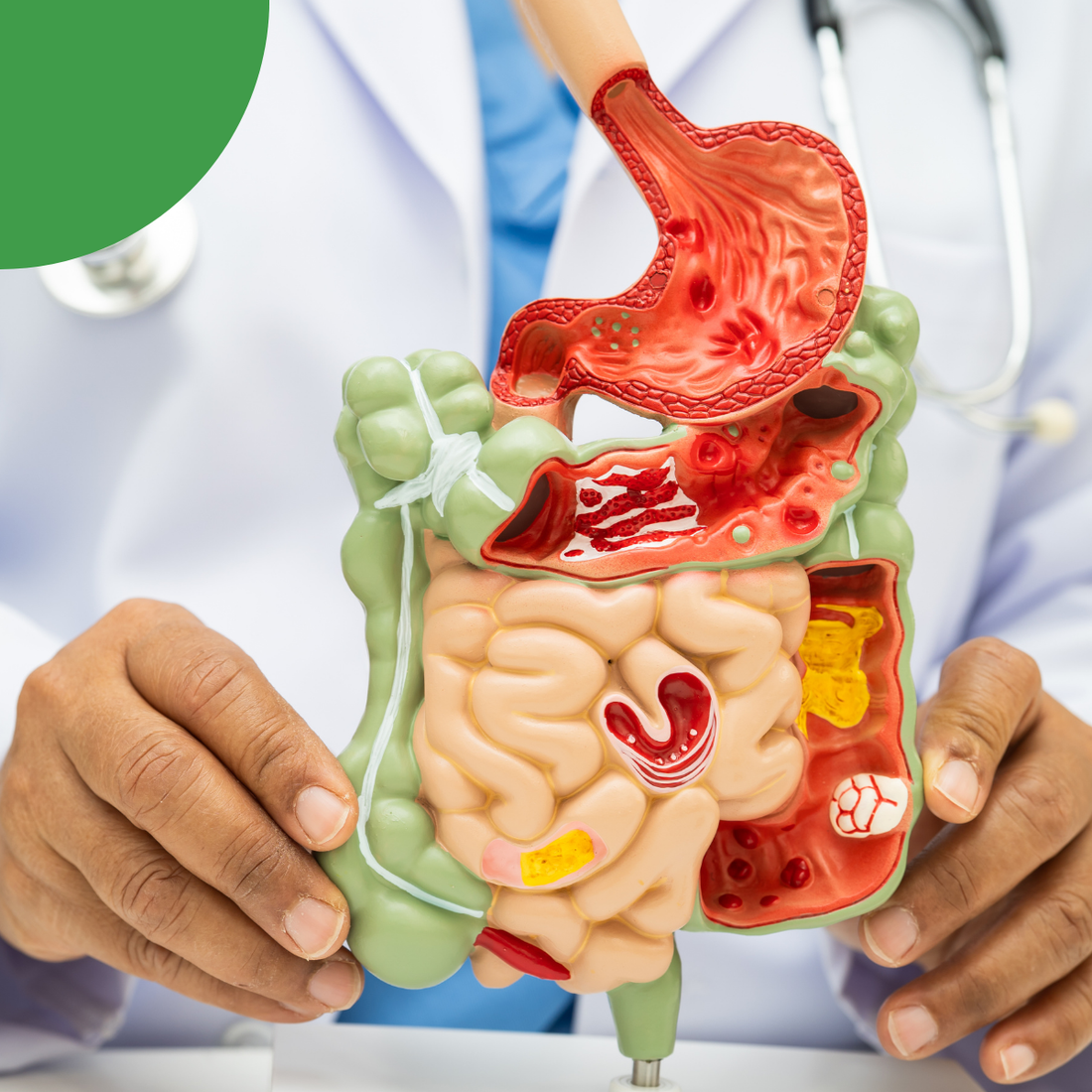 Le mucus, un composant essentiel